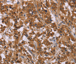 CMTM6 Polyclonal Antibody - 2