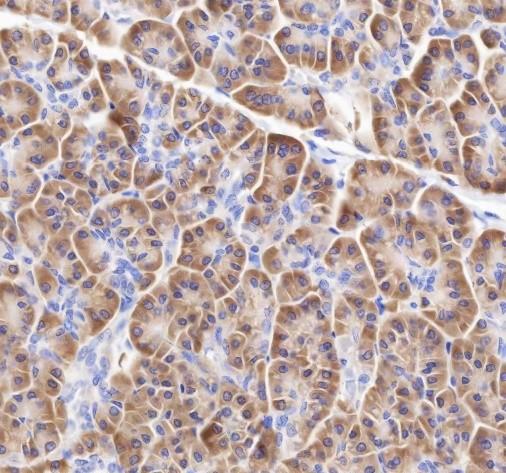 Recombinant RPL26L1 Monoclonal Antibody - small - 3