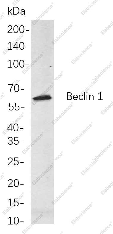 Recombinant Beclin 1 Monoclonal Antibody - 1