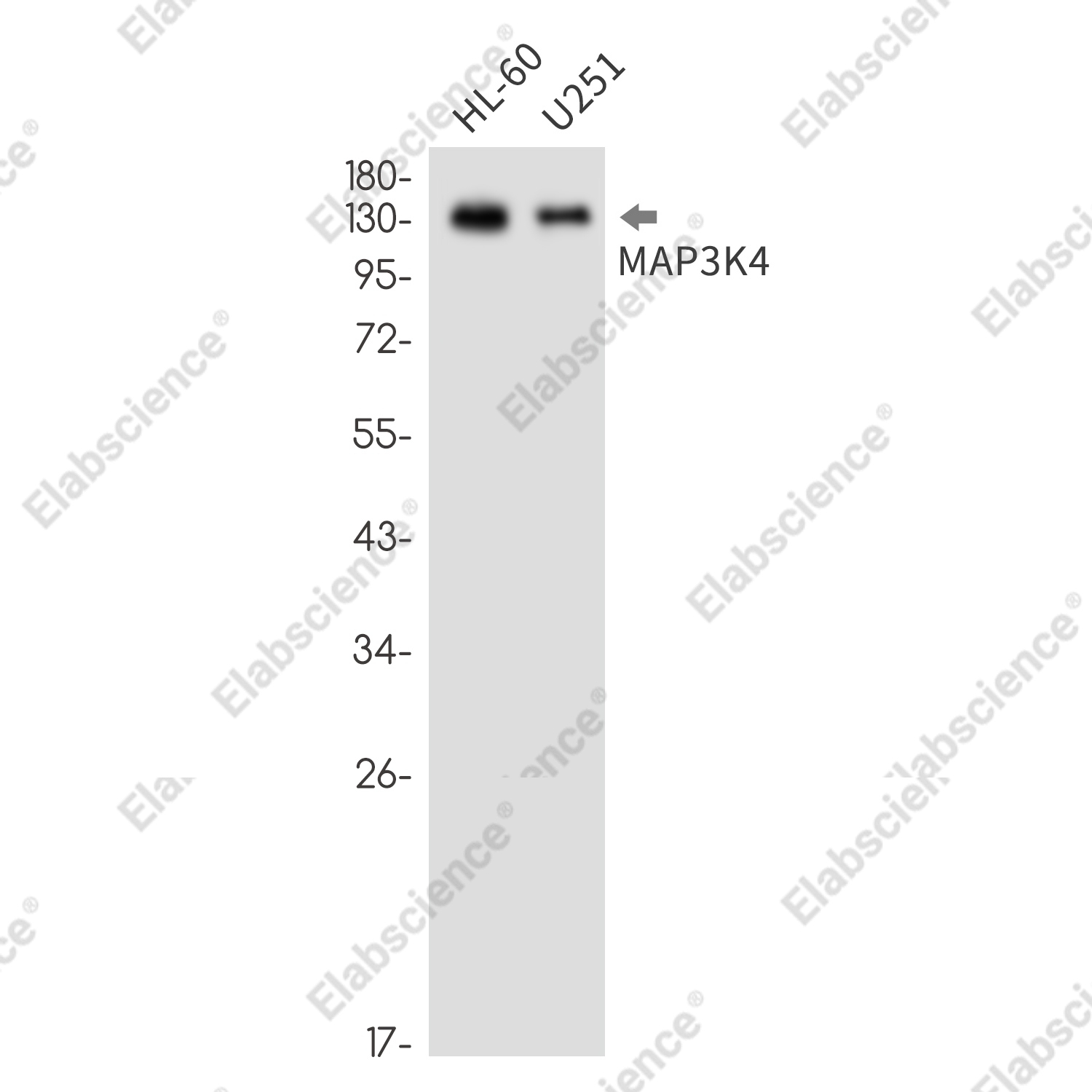 Recombinant MAP3K4 Monoclonal Antibody - 1