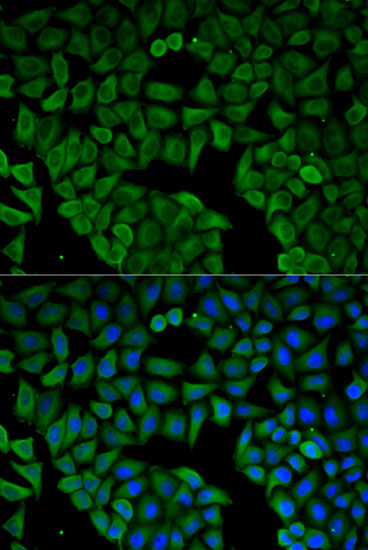 Immunofluorescence analysis of HeLa cells using CHRNA1 Polyclonal Antibody