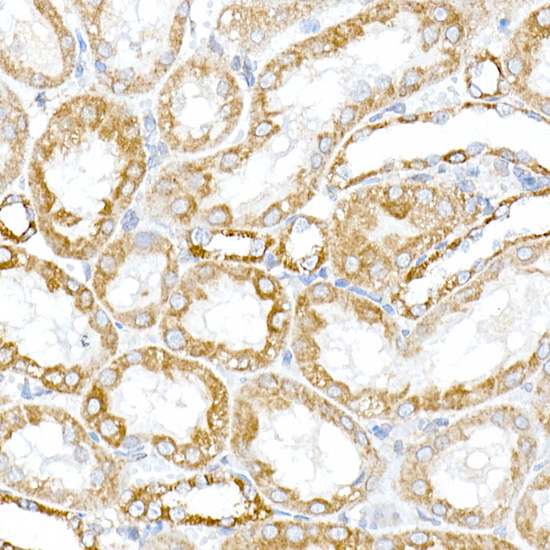 Immunohistochemistry of paraffin-embedded rat kidney using PTPIP51/RMDN3 Polyclonal Antibody at dilution of 1:100 (40x lens).Perform high pressure antigen retrieval with 10 mM citrate buffer pH 6.0 before commencing with IHC staining protocol.