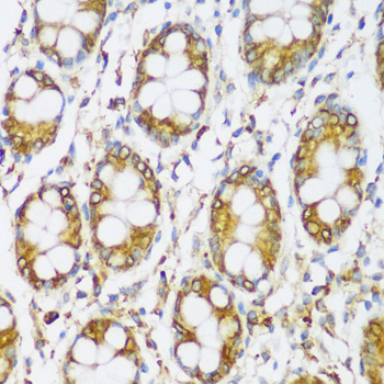 Immunohistochemistry of paraffin-embedded Human colon using ERLIN1 Polyclonal Antibody at dilution of  1:100 (40x lens).