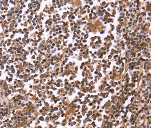 Immunohistochemistry of paraffin-embedded Human tonsil tissue using CRK Polyclonal Antibody at dilution 1:40