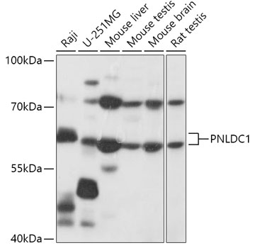 Western blot analysis of extracts of various cell lines using PNLDC1 Polyclonal Antibody at 1:1000 dilution.