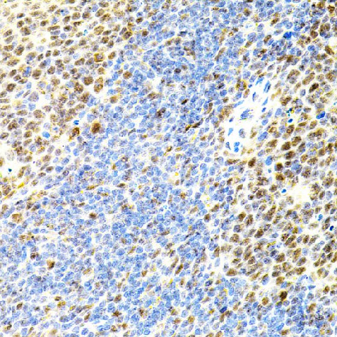 Immunohistochemistry of paraffin-embedded Mouse spleen using EIF4G2 Polyclonal Antibody