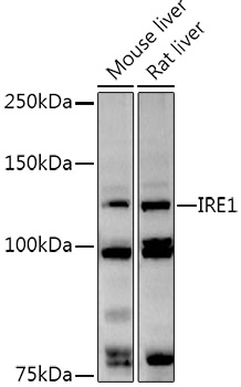 Western blot analysis of extracts of various cell lines using IRE1 Polyclonal Antibody at 1:1000 dilution.