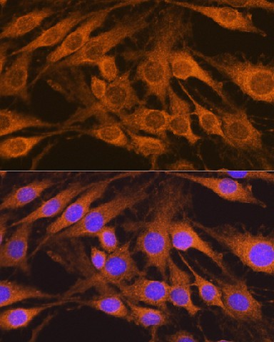 Immunofluorescence analysis of C6 cells using SDHB Polyclonal antibody at dilution of 1:100. Blue: DAPI for nuclear staining.