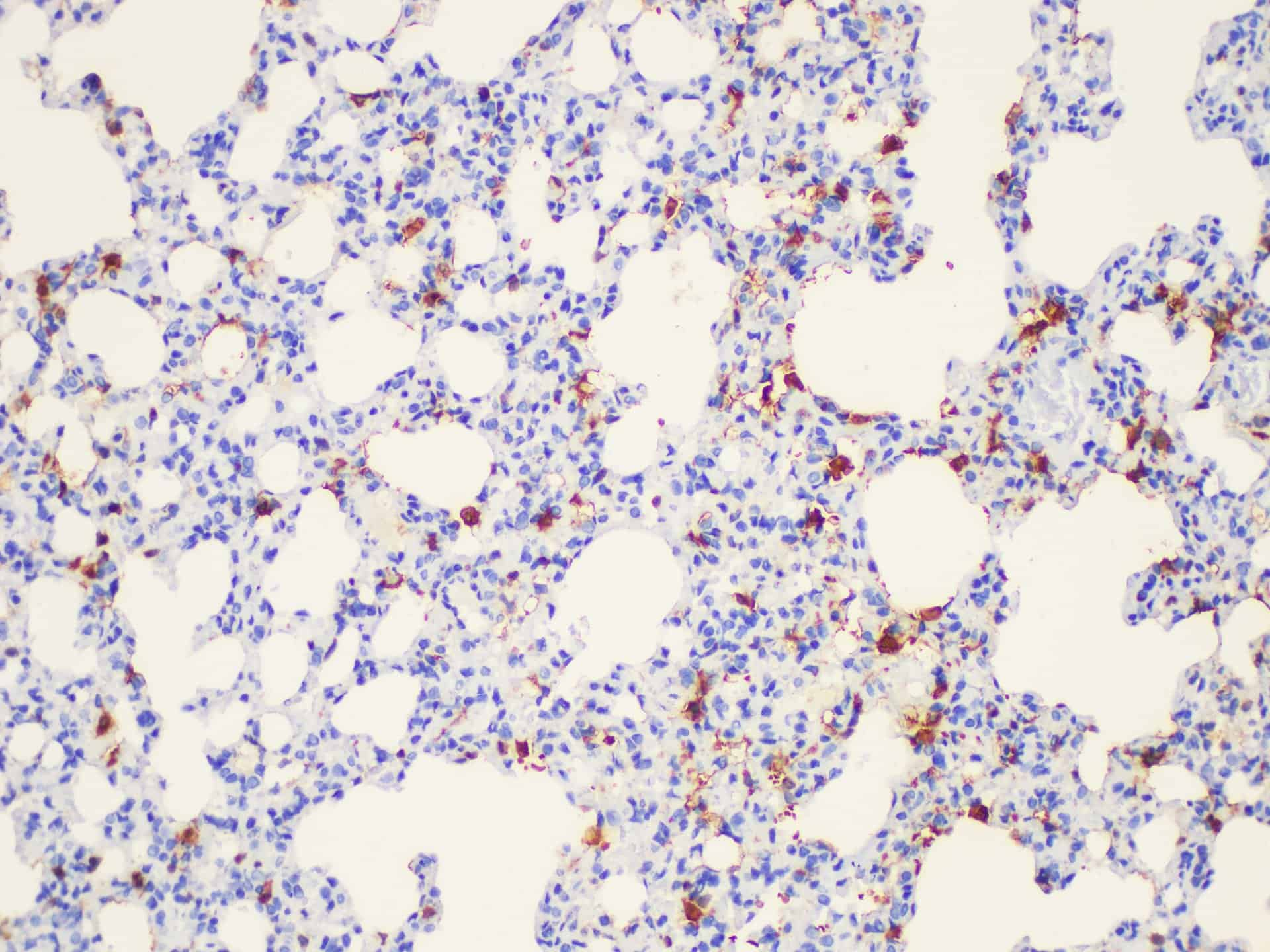 Immunohistochemistry of paraffin-embedded Rat lung using Galectin 3 Ployclonal Antibody at dilution of 1:50.