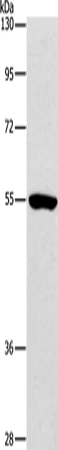 Western Blot analysis of Mouse kidney tissue using ANGPT2 Polyclonal Antibody at dilution of 1:800