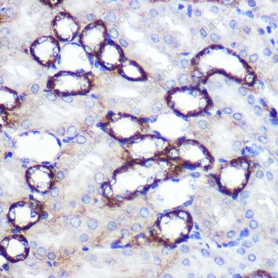 SIRT2 Polyclonal Antibody - 4
