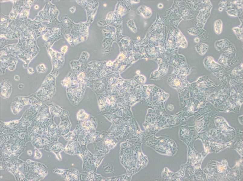 MDA-MB-175VII (L15) Cell Complete Medium - 2