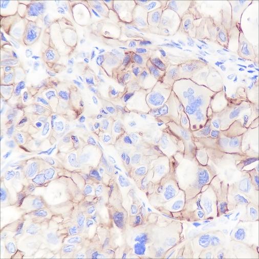 Recombinant CD47 Monoclonal Antibody-searchlist-1