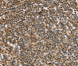 PLS3 Polyclonal Antibody - 3