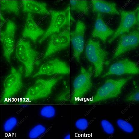Recombinant PKN1 Monoclonal Antibody - 5