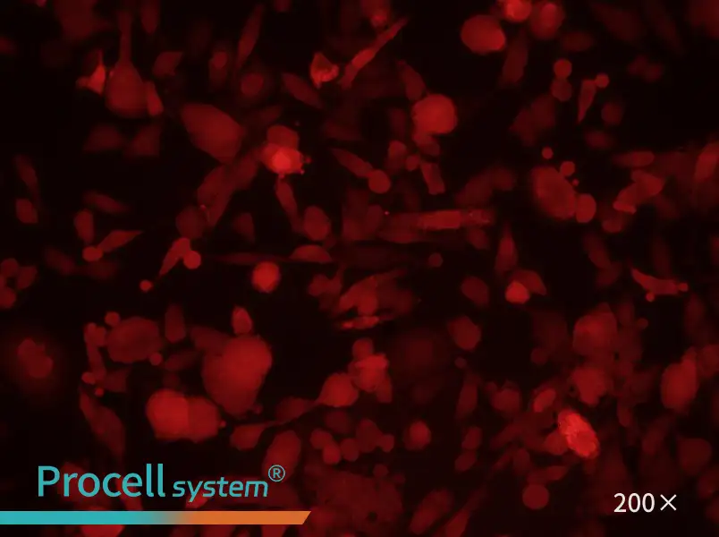 PC-3-RFP Cell Complete Medium - 1