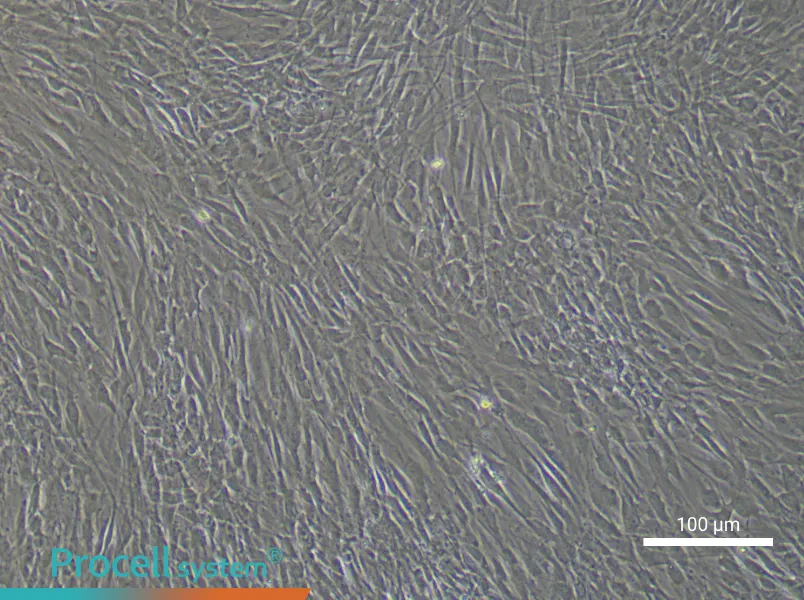 Human Uterine Smooth Muscle Cell Complete Medium - 3