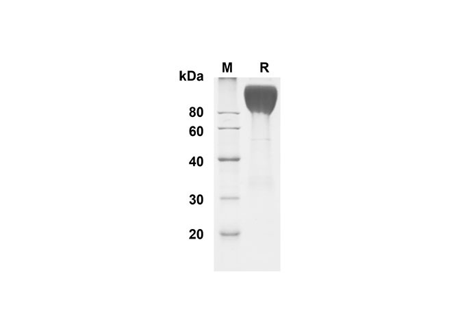 Recombinant Human CEACAM-1/CD66a Protein(Fc Tag)-1