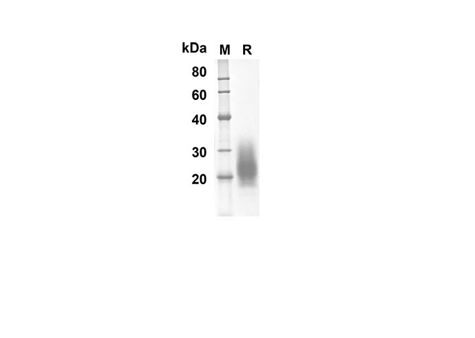 Recombinant Human CD30 Protein(Fc Tag)-产品推荐-1