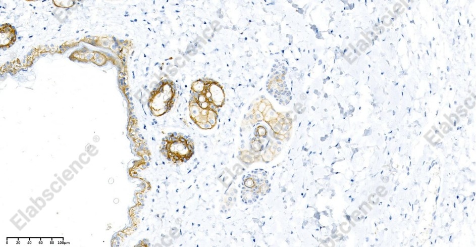 Recombinant Claudin 1 Monoclonal Antibody - 2