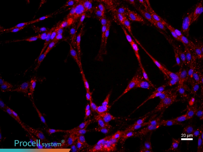 Rat Pulmonary Great Artery Endothelial Cell Complete Medium - 2