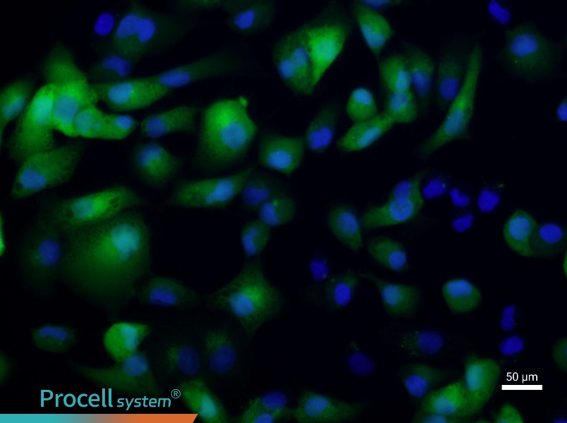 ACHN-GFP - 5