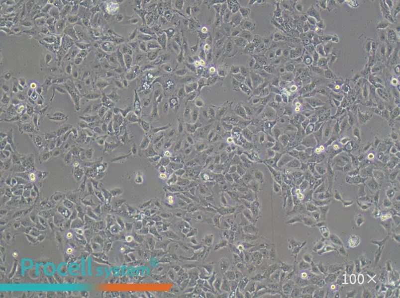 NCI-H292 Cell Complete Medium - 3