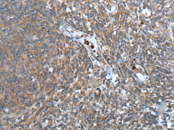 Immunohistochemistry of paraffin-embedded Human tonsil tissue  using WISP2 Polyclonal Antibody at dilution of 1:45(?200)