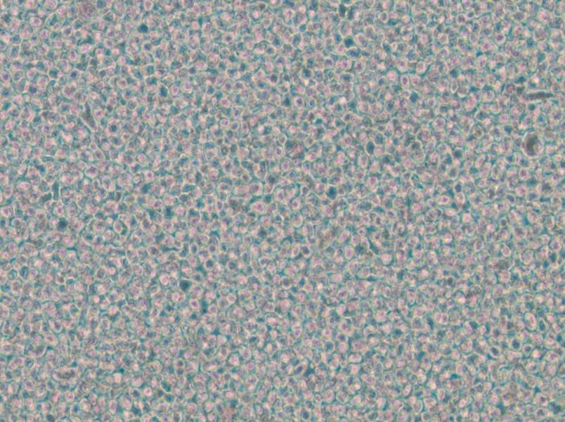 OPM2 Cell Complete Medium - 6