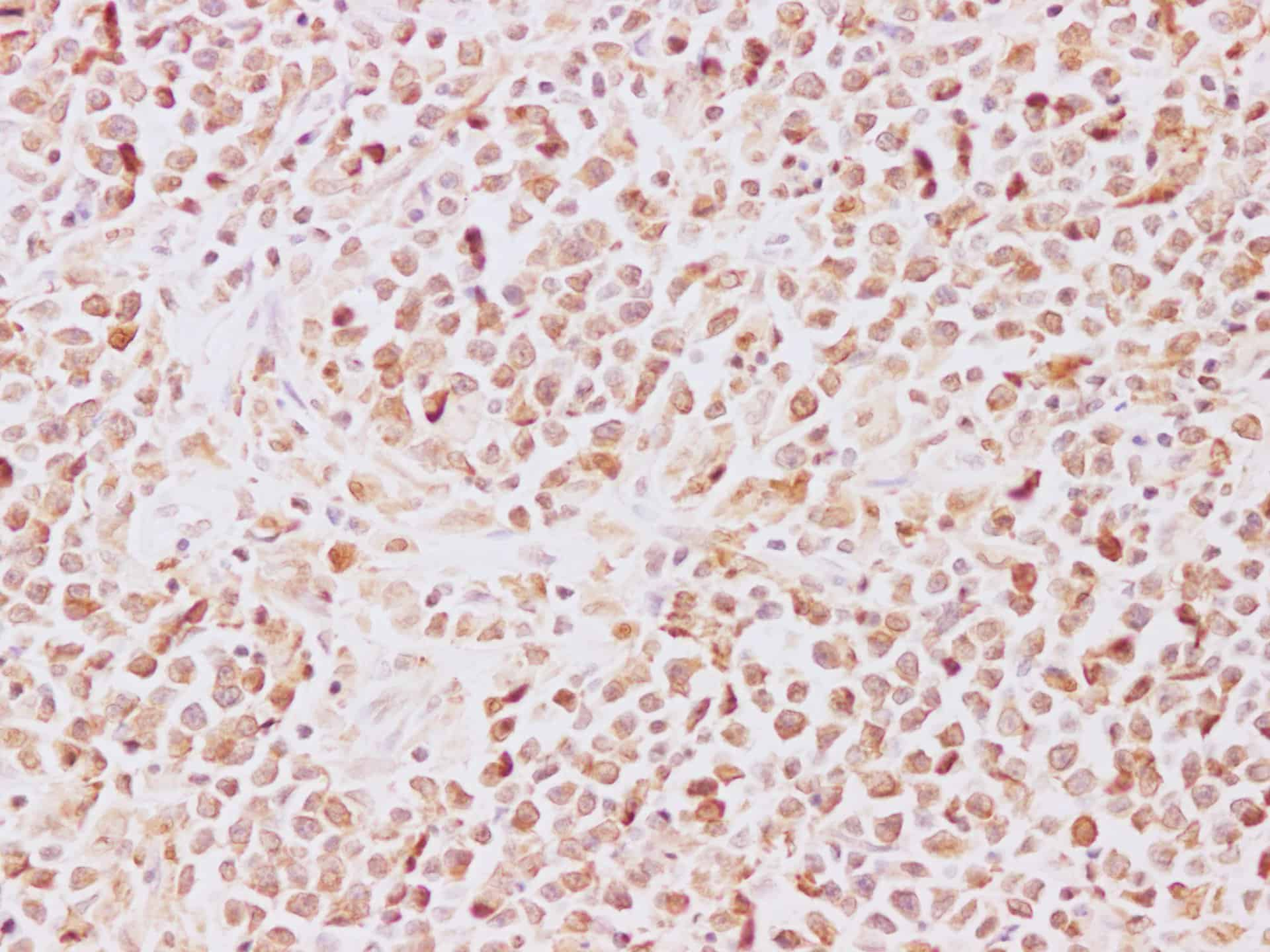 Immunohistochemistry of paraffin-embedded Human lymph node using TRAF5 Polyclonal Antibody at dilution of 1:200