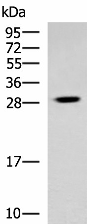 Western blot analysis of Human cerebrum tissue lysate  using TBCB Polyclonal Antibody at dilution of 1:800