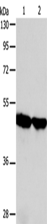 Western Blot analysis of Human fetal liver and liver cancer tissue using AADAC Polyclonal Antibody at dilution of 1:600