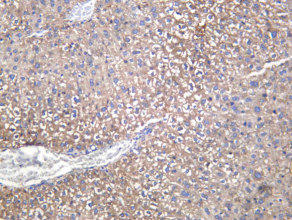 Recombinant SOCS 2 Monoclonal Antibody - 1