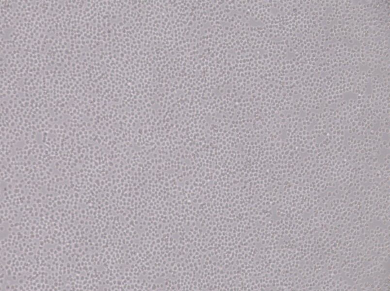 SU-DHL-8 Cell Complete Medium - 3