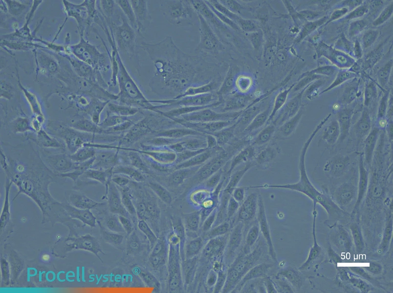 Rabbit Aortic Endothelial Cell Complete Medium - 5