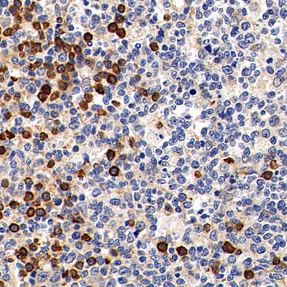 Immunohistochemistry analysis of paraffin-embedded Human tonsil  using Cyclin B1 Polyclonal Antibody at dilution of 1:300.