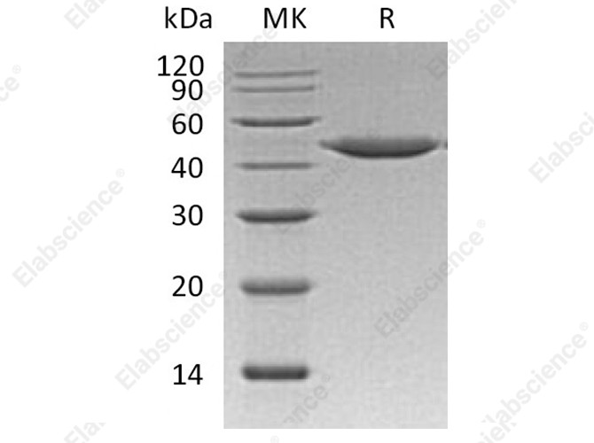 Recombinant Human Cathepsin E/CTSE Protein (His Tag) - 1