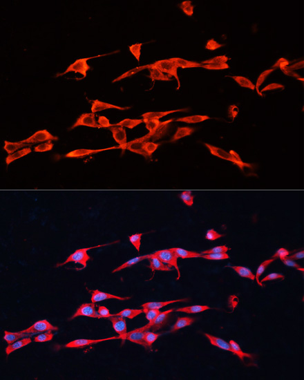 Immunofluorescence analysis of NIH/3T3 cells using GPC3 Polyclonal Antibody at dilution of  1:100. Blue: DAPI for nuclear staining.