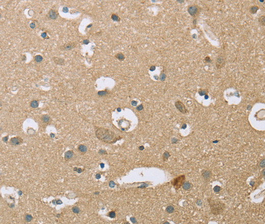 Immunohistochemistry of paraffin-embedded Human brain  using ECHS1 Polyclonal Antibody at dilution of 1:35