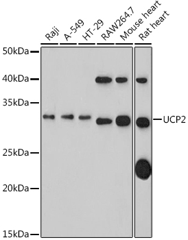 Western blot analysis of extracts of various cell lines using UCP2 Polyclonal Antibody at 1:1000 dilution.