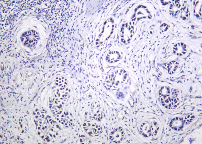 Recombinant THOC1 Monoclonal Antibody-searchlist-1