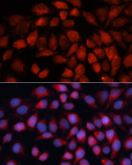 Immunofluorescence analysis of HeLa cells using ACADM Polyclonal Antibody at dilution of  1:100 (40x lens). Blue: DAPI for nuclear staining.