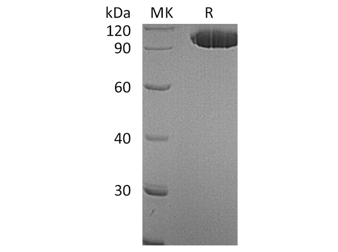 Recombinant Human EphA2 Protein (Fc Tag)(Active)