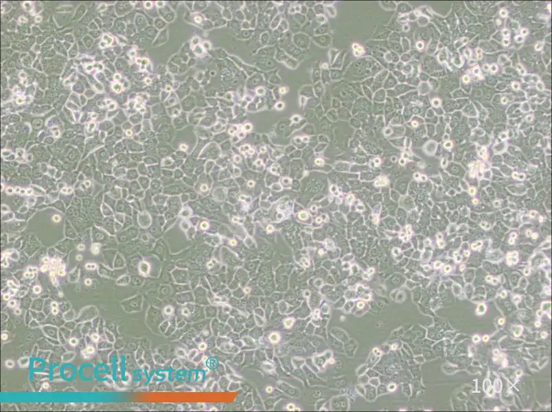 NCI-H2126 Cell Complete Medium - 2