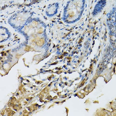 Immunohistochemistry of paraffin-embedded mouse intestin using [KO Validated] STAT5B Polyclonal Antibody at dilution of 1:100 (40x lens).Perform high pressure antigen retrieval with 10 mM citrate buffer pH 6.0 before commencing with IHC staining protocol.