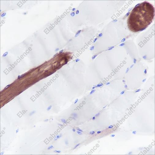 Recombinant Myosin Light Chain 3 Monoclonal Antibody - 4