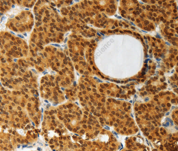 AKR1A1 Polyclonal Antibody - 2