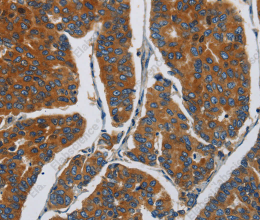 APEH Polyclonal Antibody - 2