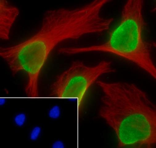Recombinant Histone H4 (Mono Methyl Lys12) Monoclonal Antibody - small - 5
