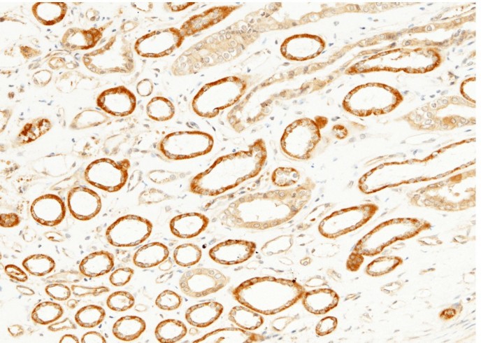 Recombinant JNK2/MAPK9 Monoclonal Antibody - small - 2